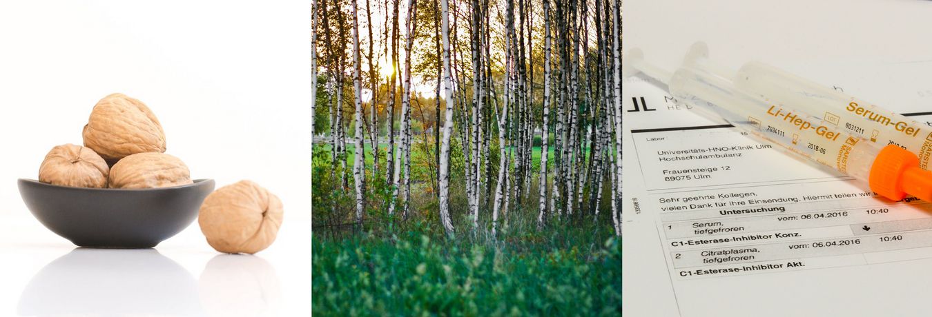 Nüsse in der Schale; Birkenwald; Abstrichröhrchen